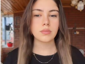 Ultimate Hair Growth Solution – Minoxidil 4-Months Results